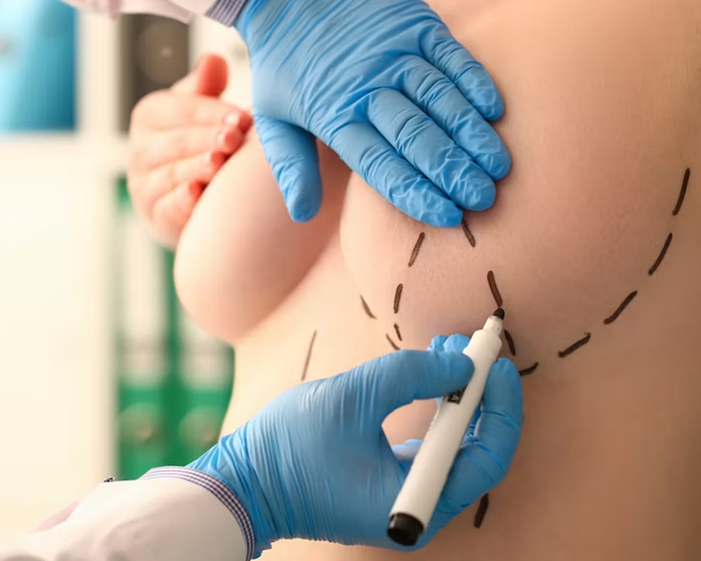 Surgeon consulting a patient about Hybrid Breast Augmentation